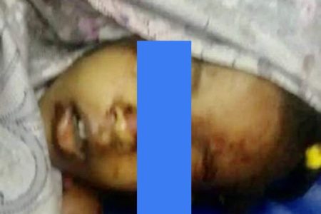 5 years old killed by Sudanese security forces